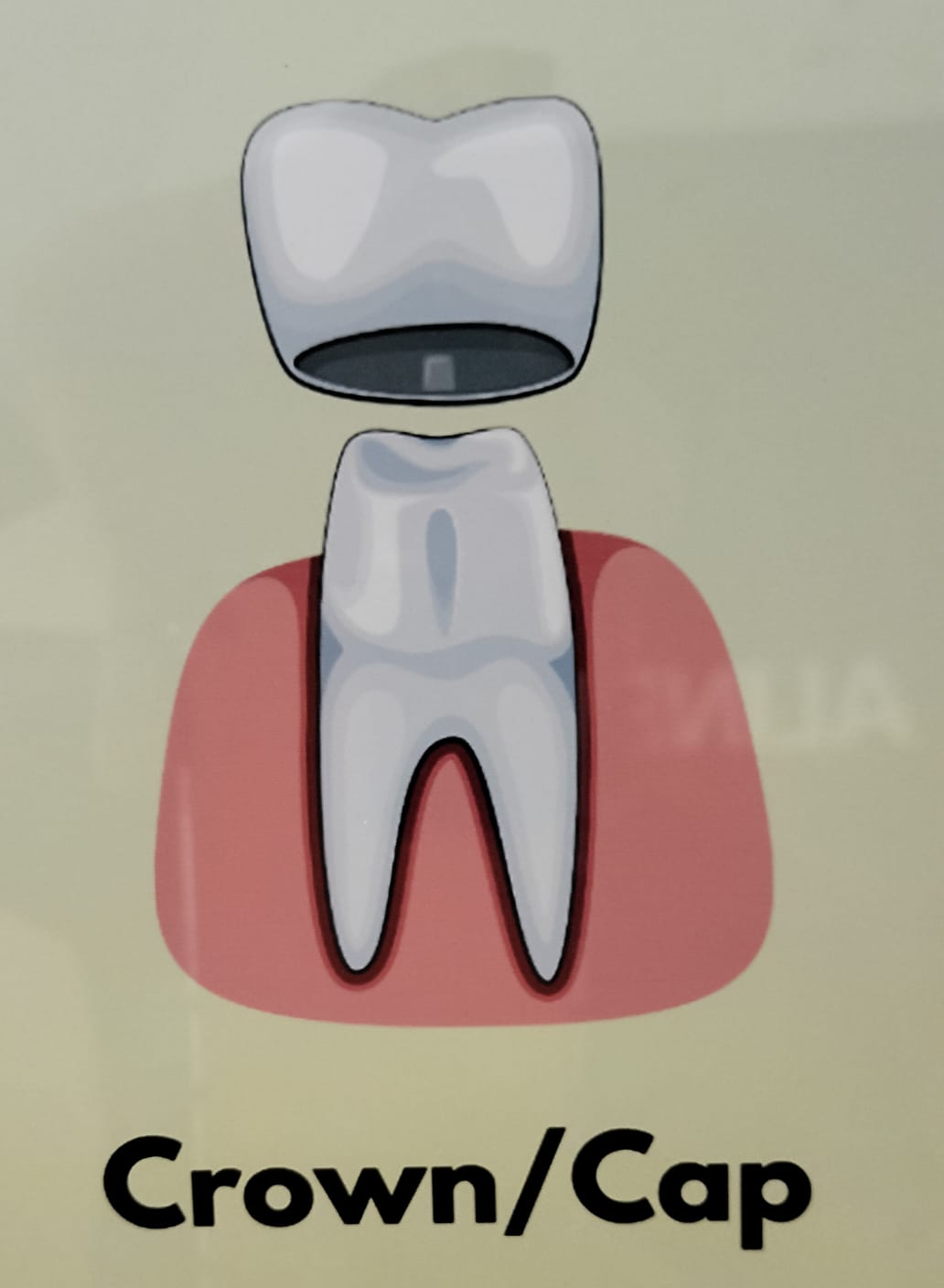 Crown Cap